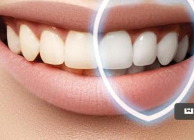 زردی دندان را به راحتی از بین ببرید